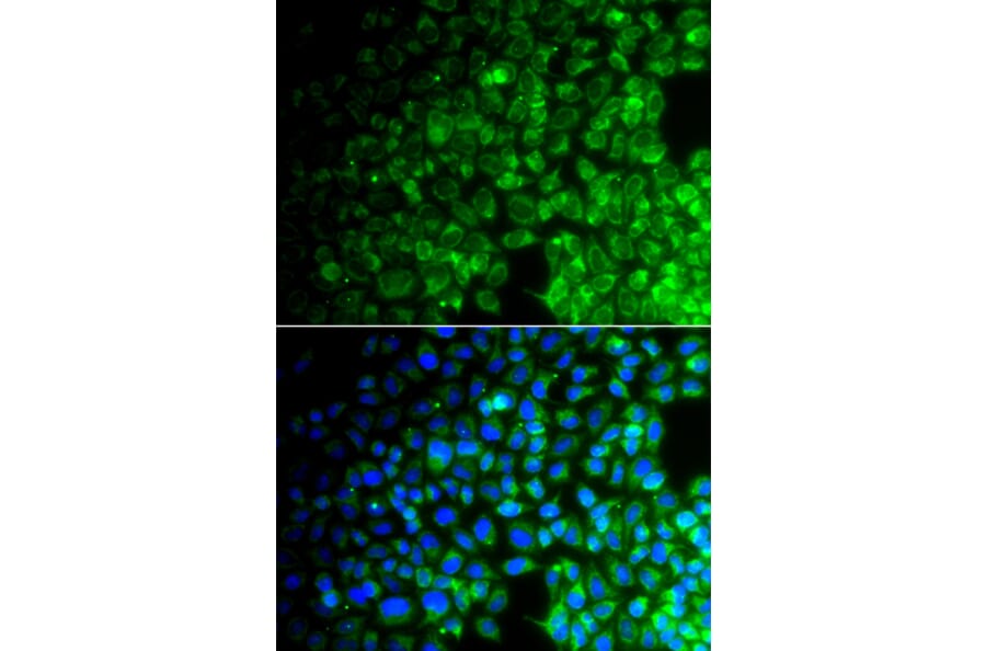 Immunofluorescence - Anti-USP10 Antibody (A92436) - Antibodies.com