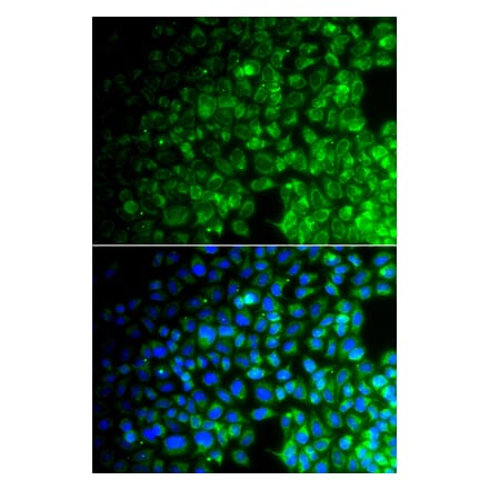 Immunofluorescence - Anti-USP10 Antibody (A92436) - Antibodies.com