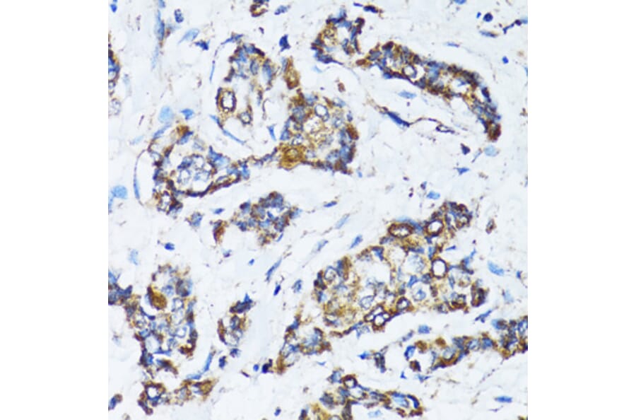 Immunohistochemistry - Anti-ATG7 Antibody (A92437) - Antibodies.com