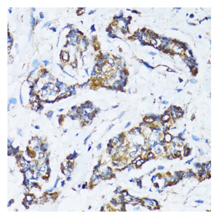 Immunohistochemistry - Anti-ATG7 Antibody (A92437) - Antibodies.com
