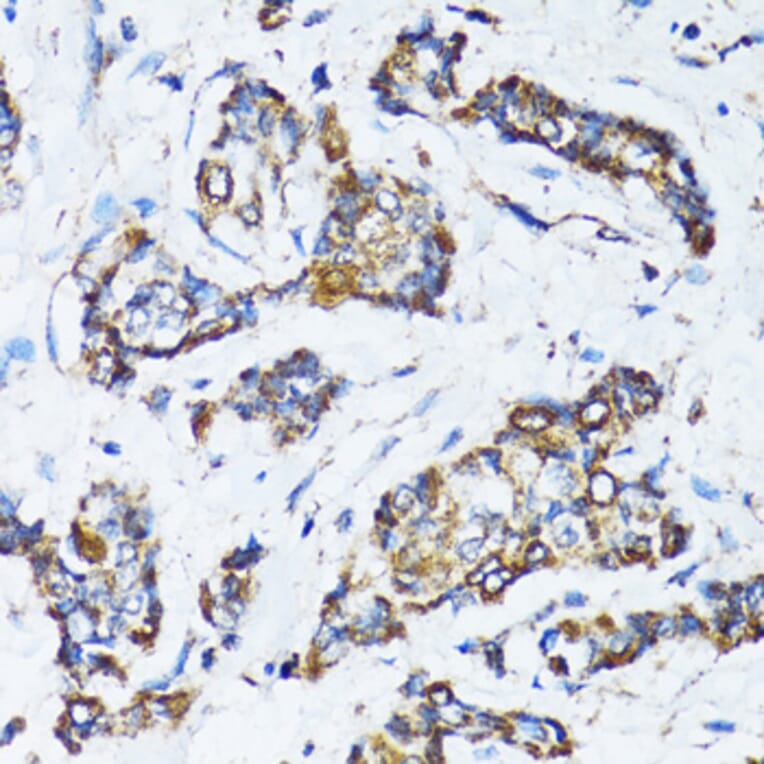 Immunohistochemistry - Anti-ATG7 Antibody (A92437) - Antibodies.com
