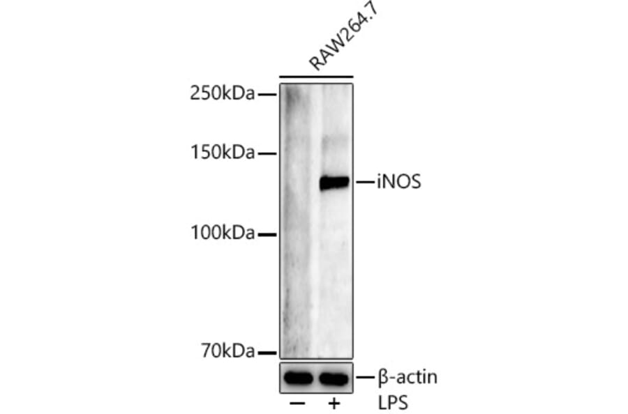 Western Blot - Anti-iNOS Antibody (A92438) - Antibodies.com
