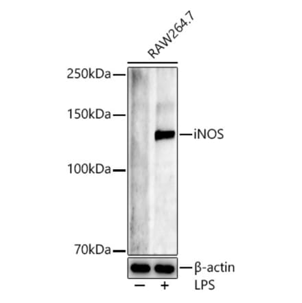 Western Blot - Anti-iNOS Antibody (A92438) - Antibodies.com