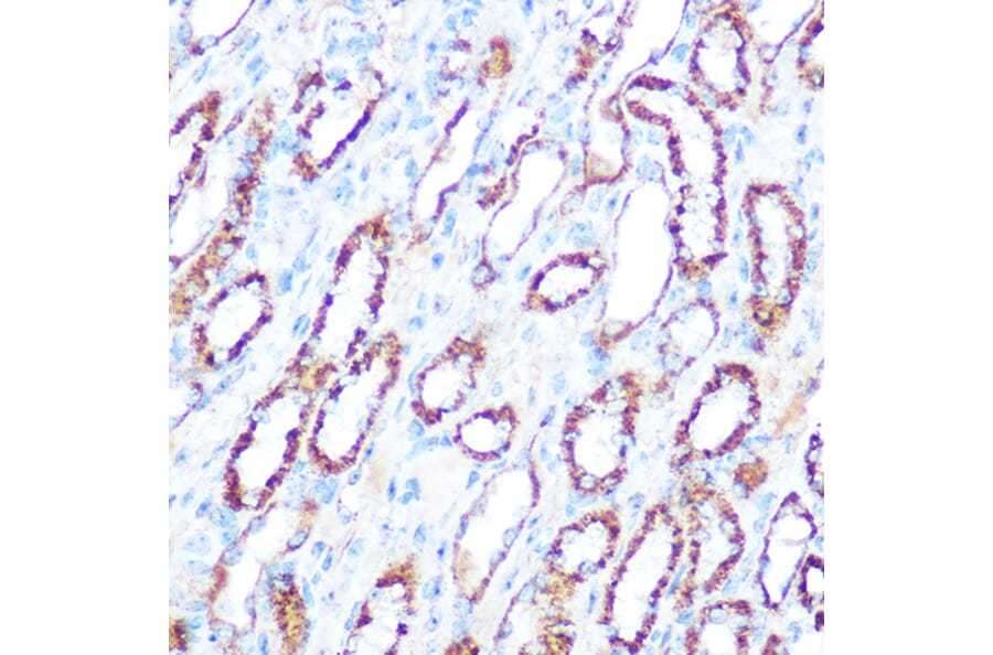Immunohistochemistry - Anti-iNOS Antibody (A92438) - Antibodies.com