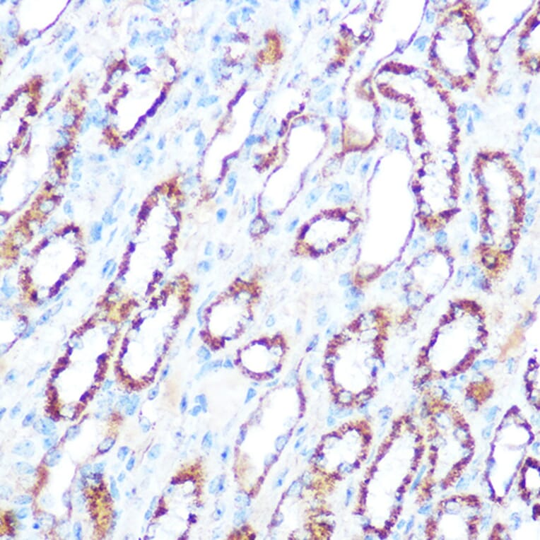 Immunohistochemistry - Anti-iNOS Antibody (A92438) - Antibodies.com