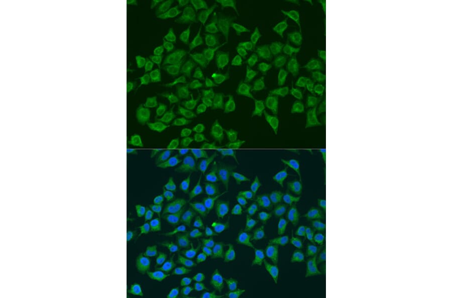 Immunofluorescence - Anti-iNOS Antibody (A92438) - Antibodies.com