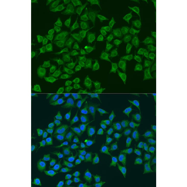 Immunofluorescence - Anti-iNOS Antibody (A92438) - Antibodies.com