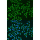 Immunofluorescence - Anti-iNOS Antibody (A92438) - Antibodies.com