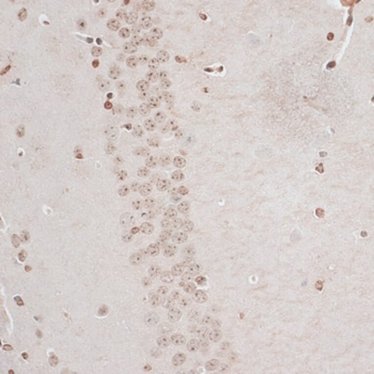 Immunohistochemistry - Anti-ZNF177 Antibody (A92439) - Antibodies.com