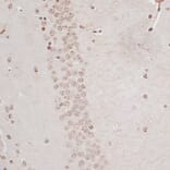Immunohistochemistry - Anti-ZNF177 Antibody (A92439) - Antibodies.com