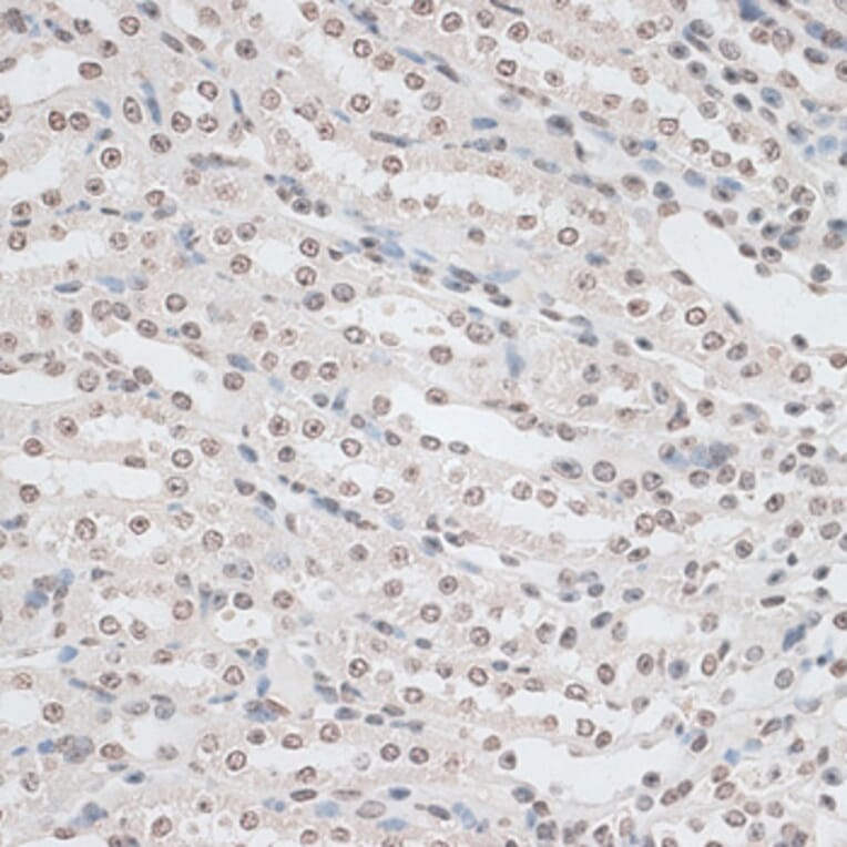 Immunohistochemistry - Anti-ZNF177 Antibody (A92439) - Antibodies.com