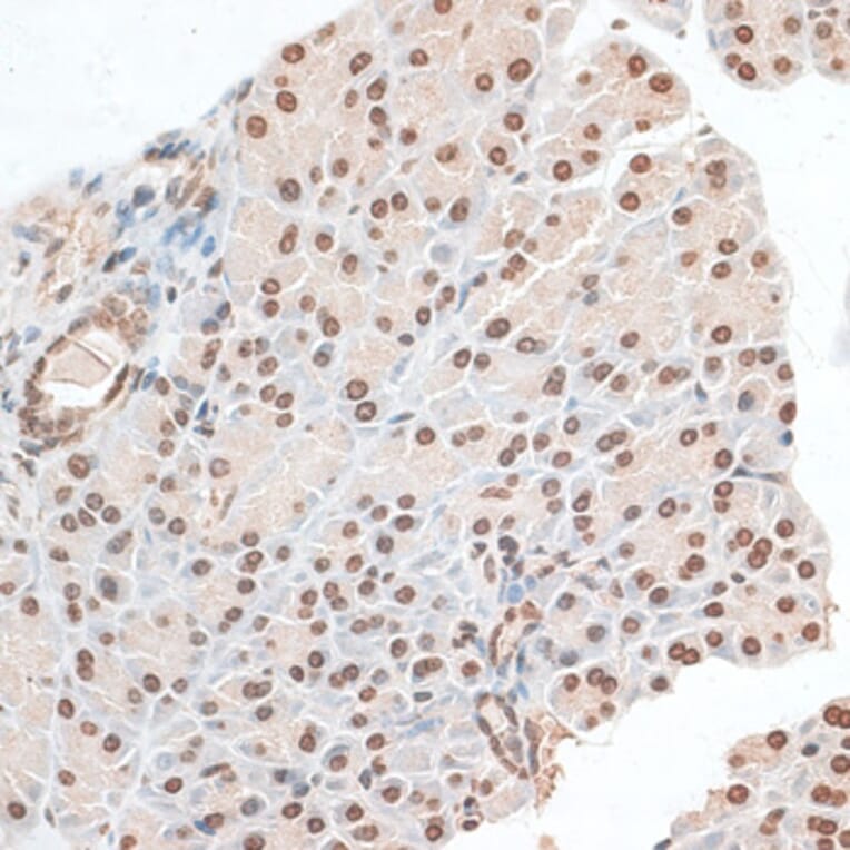 Immunohistochemistry - Anti-ZNF177 Antibody (A92439) - Antibodies.com