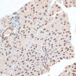 Immunohistochemistry - Anti-ZNF177 Antibody (A92439) - Antibodies.com