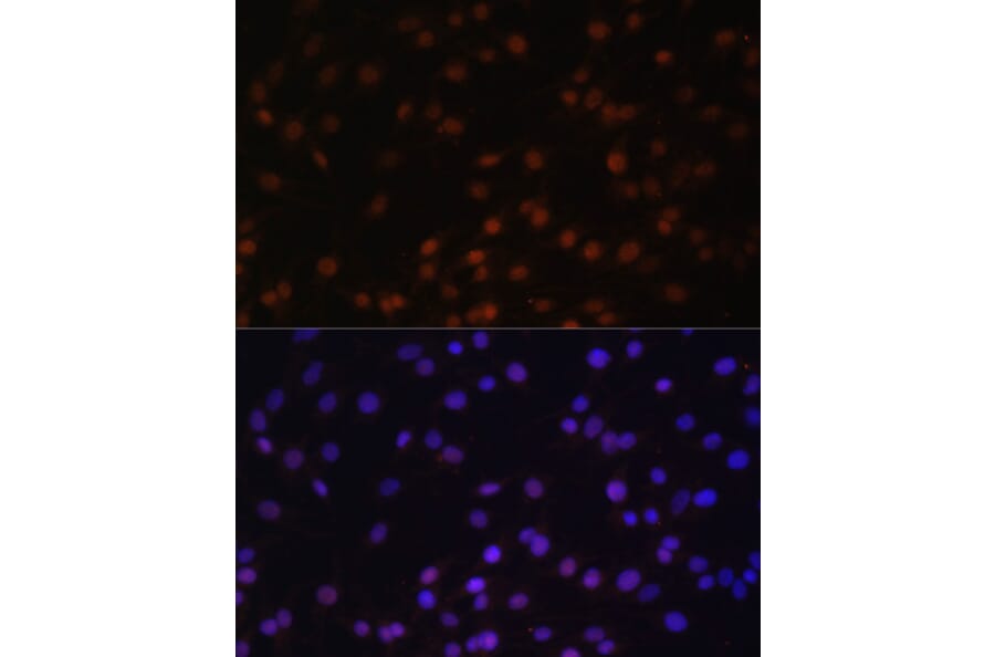 Immunofluorescence - Anti-ZNF177 Antibody (A92439) - Antibodies.com