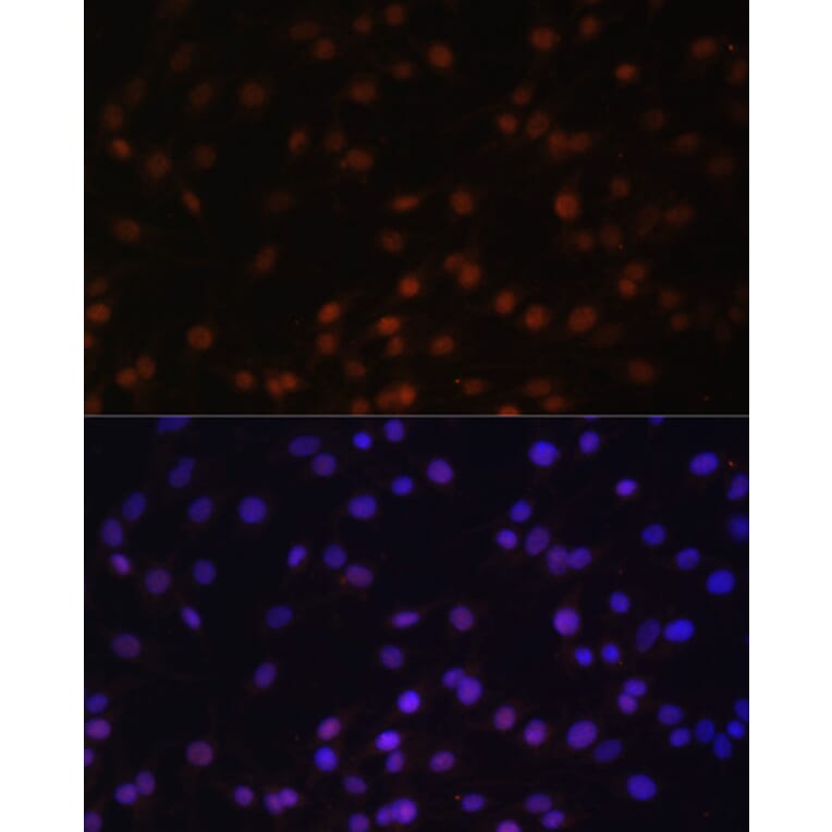 Immunofluorescence - Anti-ZNF177 Antibody (A92439) - Antibodies.com
