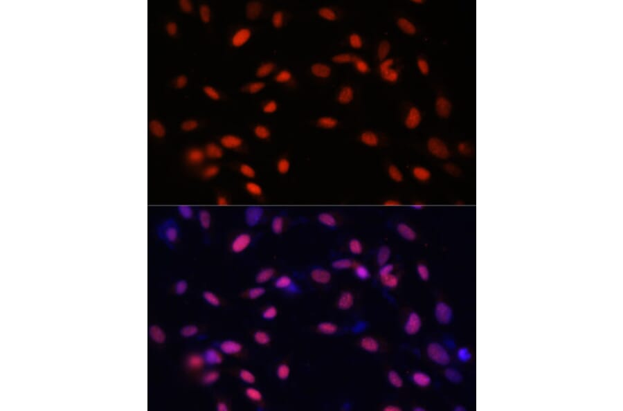 Immunofluorescence - Anti-ZNF177 Antibody (A92439) - Antibodies.com