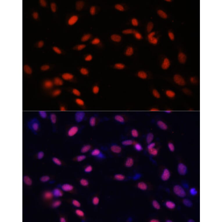 Immunofluorescence - Anti-ZNF177 Antibody (A92439) - Antibodies.com