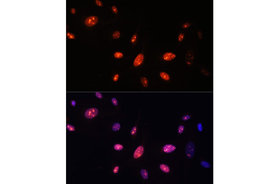 Immunofluorescence - Anti-ZNF177 Antibody (A92439) - Antibodies.com
