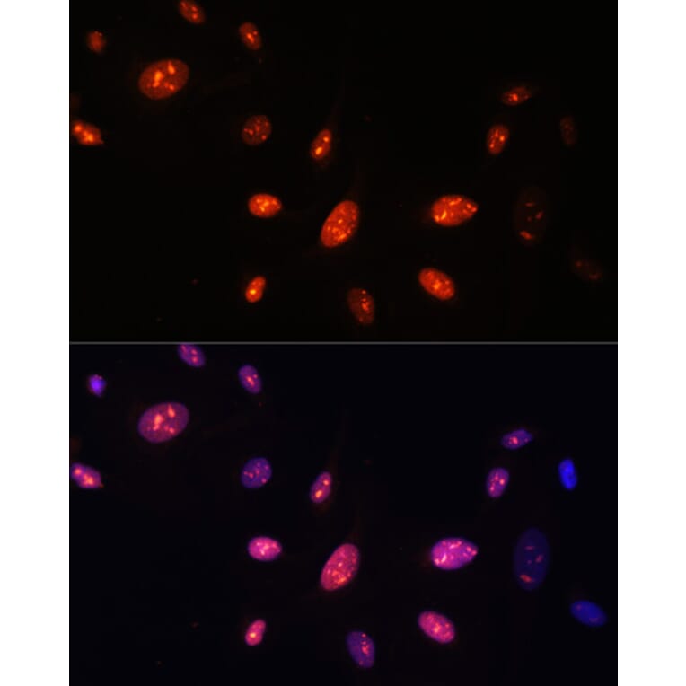 Immunofluorescence - Anti-ZNF177 Antibody (A92439) - Antibodies.com