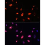 Immunofluorescence - Anti-ZNF177 Antibody (A92439) - Antibodies.com