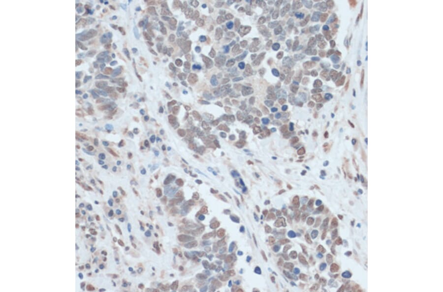 Immunohistochemistry - Anti-ZNF707 Antibody (A13737) - Antibodies.com