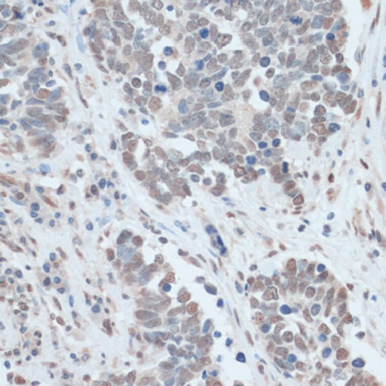 Immunohistochemistry - Anti-ZNF707 Antibody (A13737) - Antibodies.com