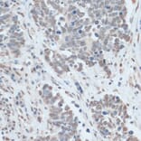 Immunohistochemistry - Anti-ZNF707 Antibody (A13737) - Antibodies.com