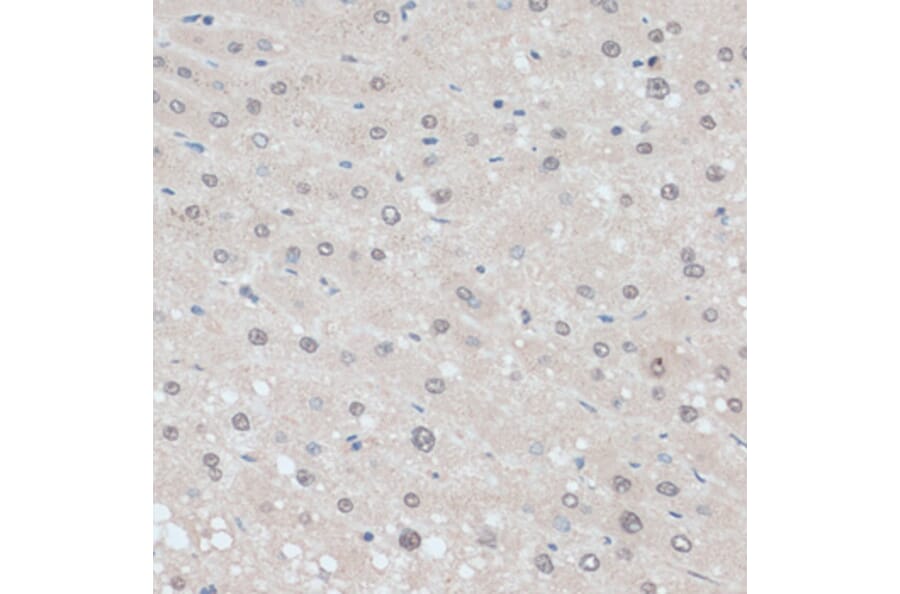 Immunohistochemistry - Anti-ZNF707 Antibody (A13737) - Antibodies.com