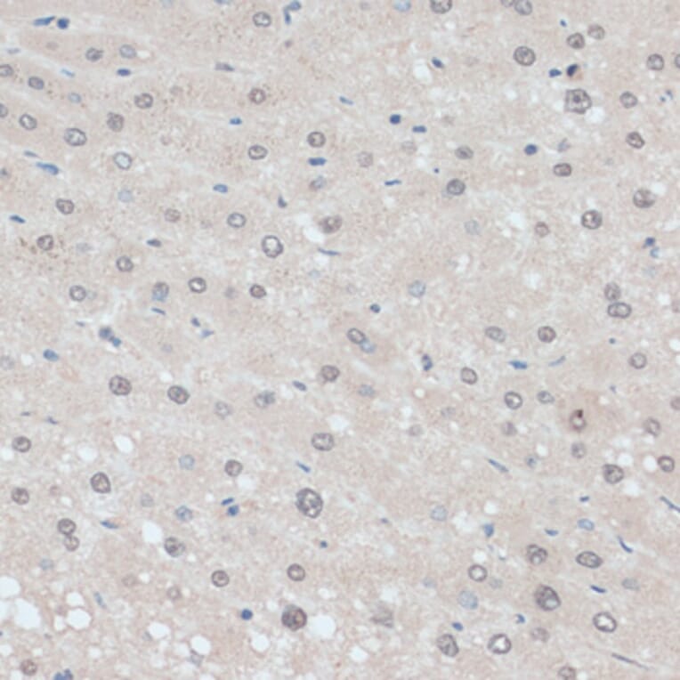 Immunohistochemistry - Anti-ZNF707 Antibody (A13737) - Antibodies.com