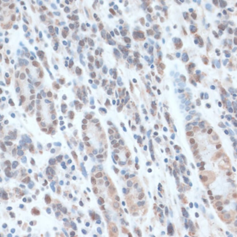 Immunohistochemistry - Anti-ZNF707 Antibody (A13737) - Antibodies.com