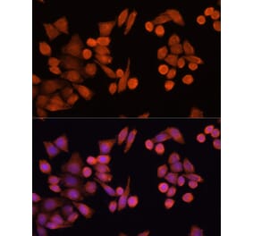 Immunofluorescence - Anti-PLA2G4D Antibody (A92443) - Antibodies.com