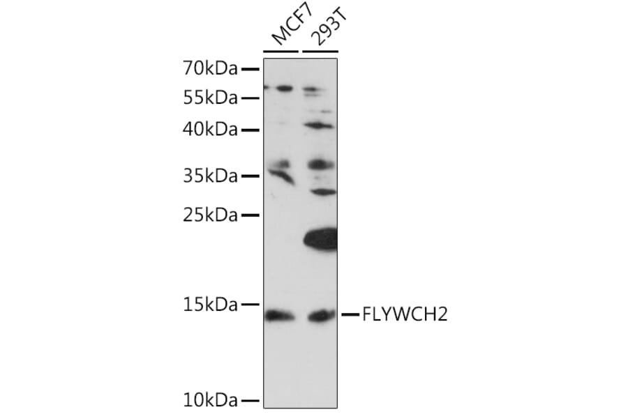 Western Blot - Anti-FLYWCH2 Antibody (A92444) - Antibodies.com