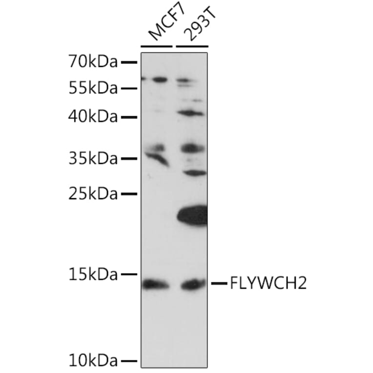 Western Blot - Anti-FLYWCH2 Antibody (A92444) - Antibodies.com