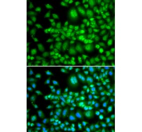 Immunofluorescence - Anti-SETD5 Antibody (A92447) - Antibodies.com