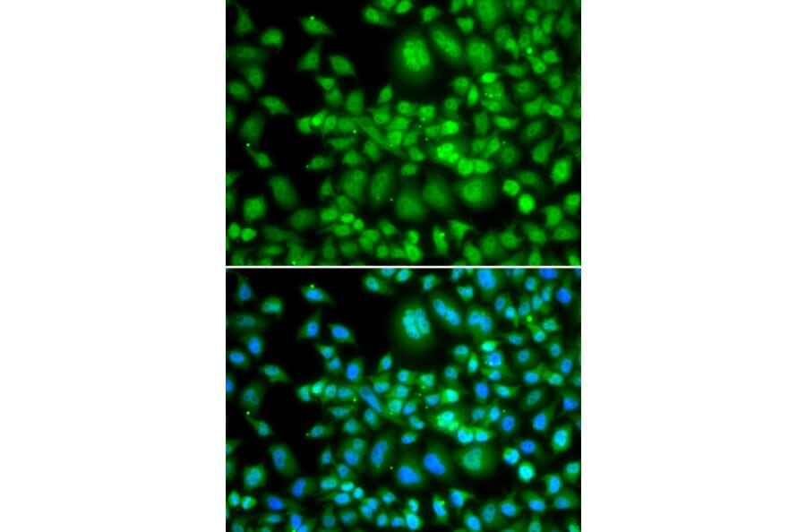 Immunofluorescence - Anti-SETD5 Antibody (A92447) - Antibodies.com