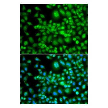 Immunofluorescence - Anti-SETD5 Antibody (A92447) - Antibodies.com