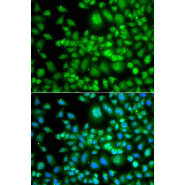 Immunofluorescence - Anti-SETD5 Antibody (A92447) - Antibodies.com