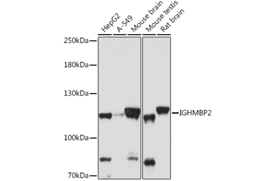 Western Blot - Anti-IGHMBP2 Antibody (A92449) - Antibodies.com