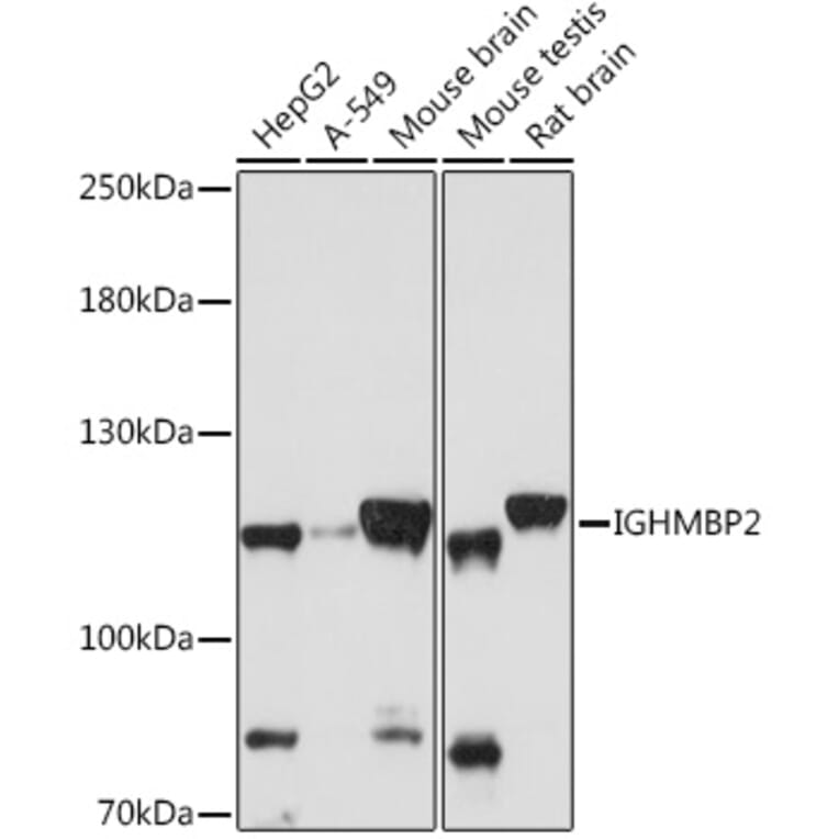 Western Blot - Anti-IGHMBP2 Antibody (A92449) - Antibodies.com