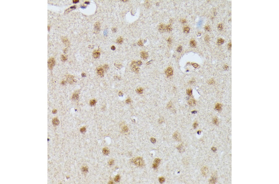 Immunohistochemistry - Anti-IGHMBP2 Antibody (A92449) - Antibodies.com