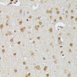 Immunohistochemistry - Anti-IGHMBP2 Antibody (A92449) - Antibodies.com