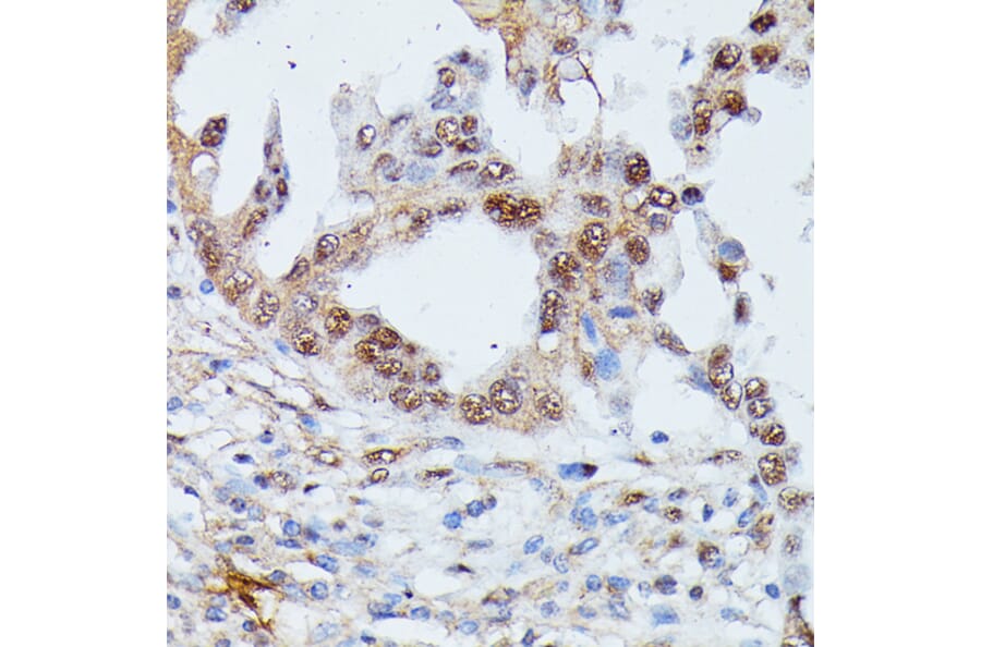 Immunohistochemistry - Anti-IGHMBP2 Antibody (A92449) - Antibodies.com