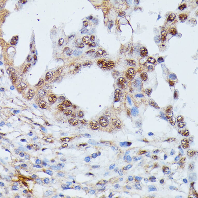 Immunohistochemistry - Anti-IGHMBP2 Antibody (A92449) - Antibodies.com