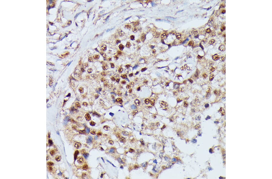 Immunohistochemistry - Anti-IGHMBP2 Antibody (A92449) - Antibodies.com