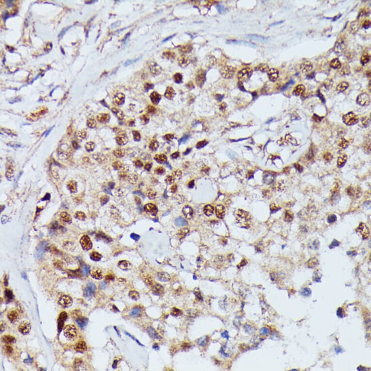 Immunohistochemistry - Anti-IGHMBP2 Antibody (A92449) - Antibodies.com