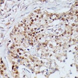 Immunohistochemistry - Anti-IGHMBP2 Antibody (A92449) - Antibodies.com