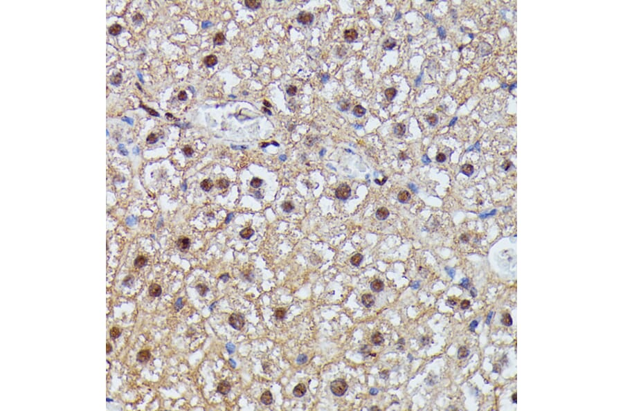 Immunohistochemistry - Anti-IGHMBP2 Antibody (A92449) - Antibodies.com