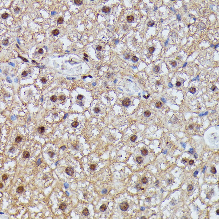 Immunohistochemistry - Anti-IGHMBP2 Antibody (A92449) - Antibodies.com