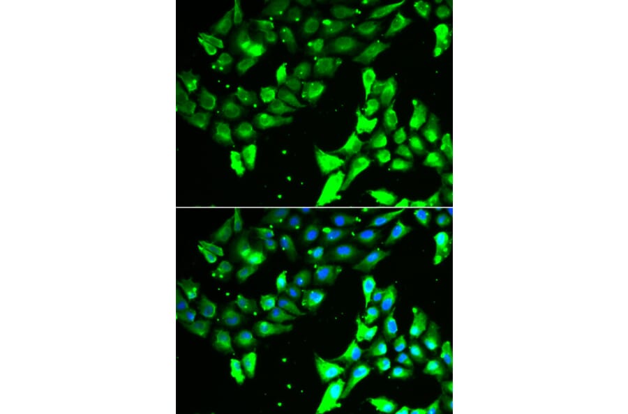 Immunofluorescence - Anti-KIF2B Antibody (A13600) - Antibodies.com