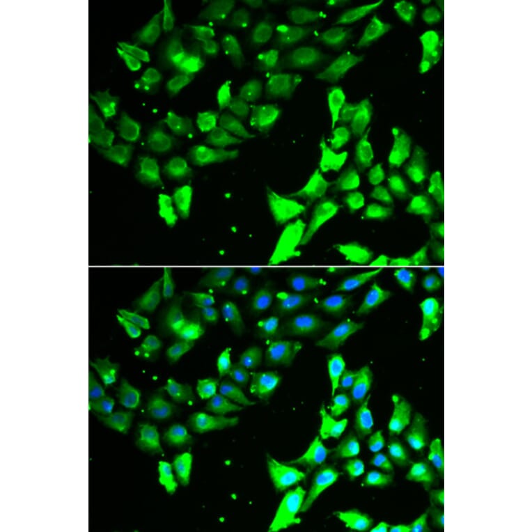 Immunofluorescence - Anti-KIF2B Antibody (A13600) - Antibodies.com